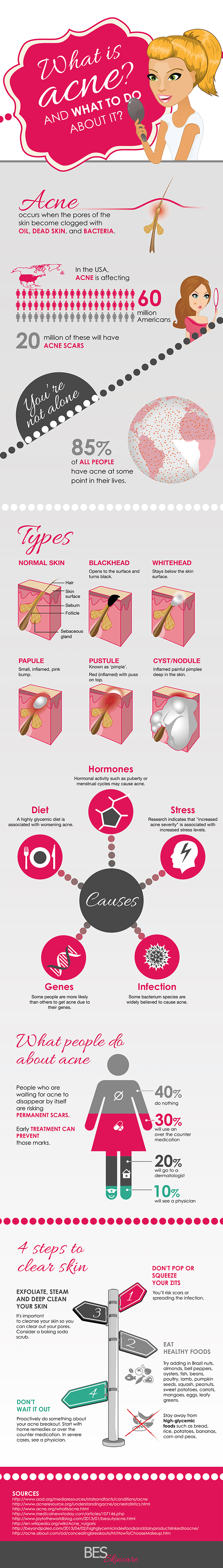 Acne graphic infographic about 