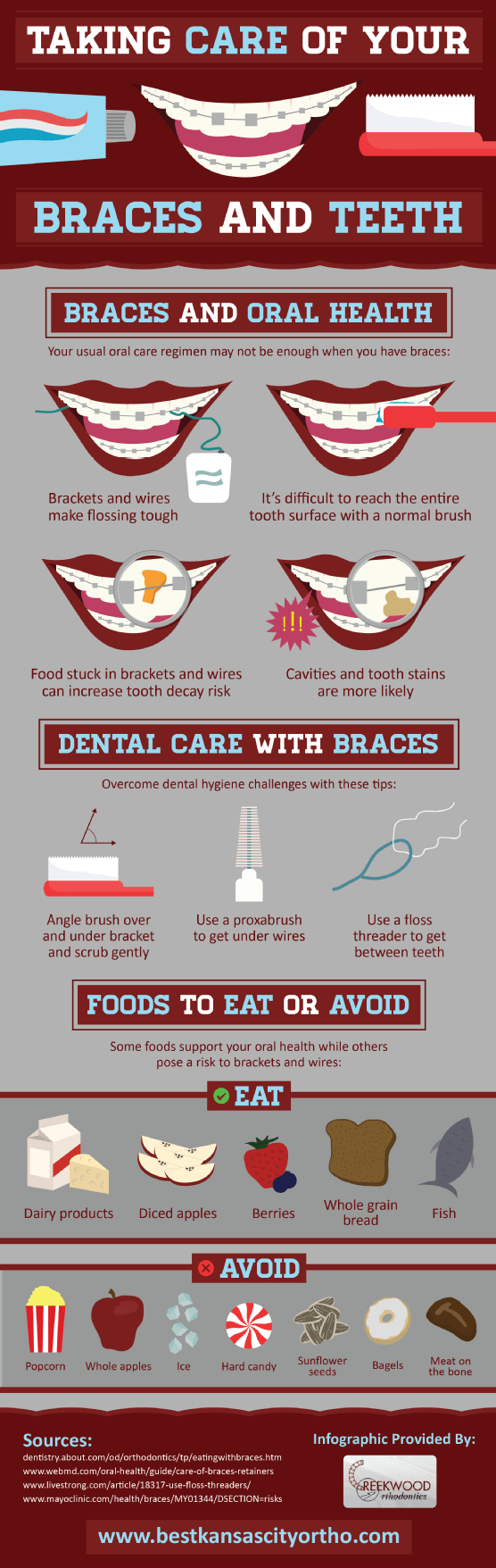Taking Care of Your Braces and Teeth infographic about data visualization, infographics